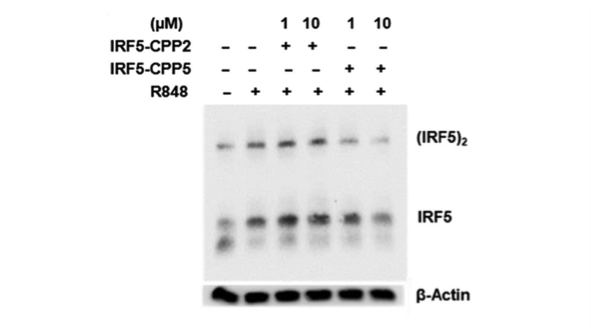 Blot-IRF5-Native.png
