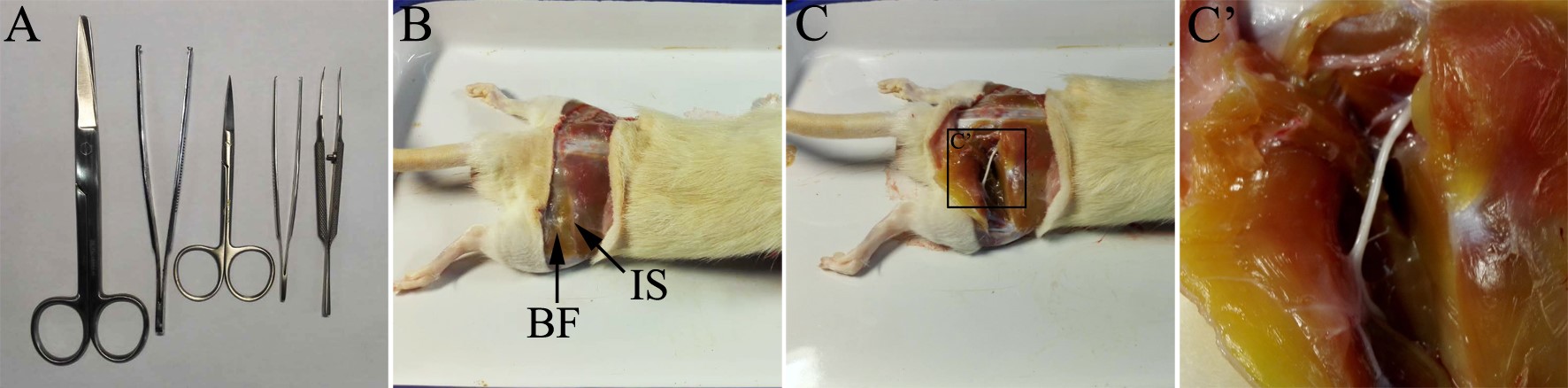 preparationofteasednervefibersfromratsciaticnerve