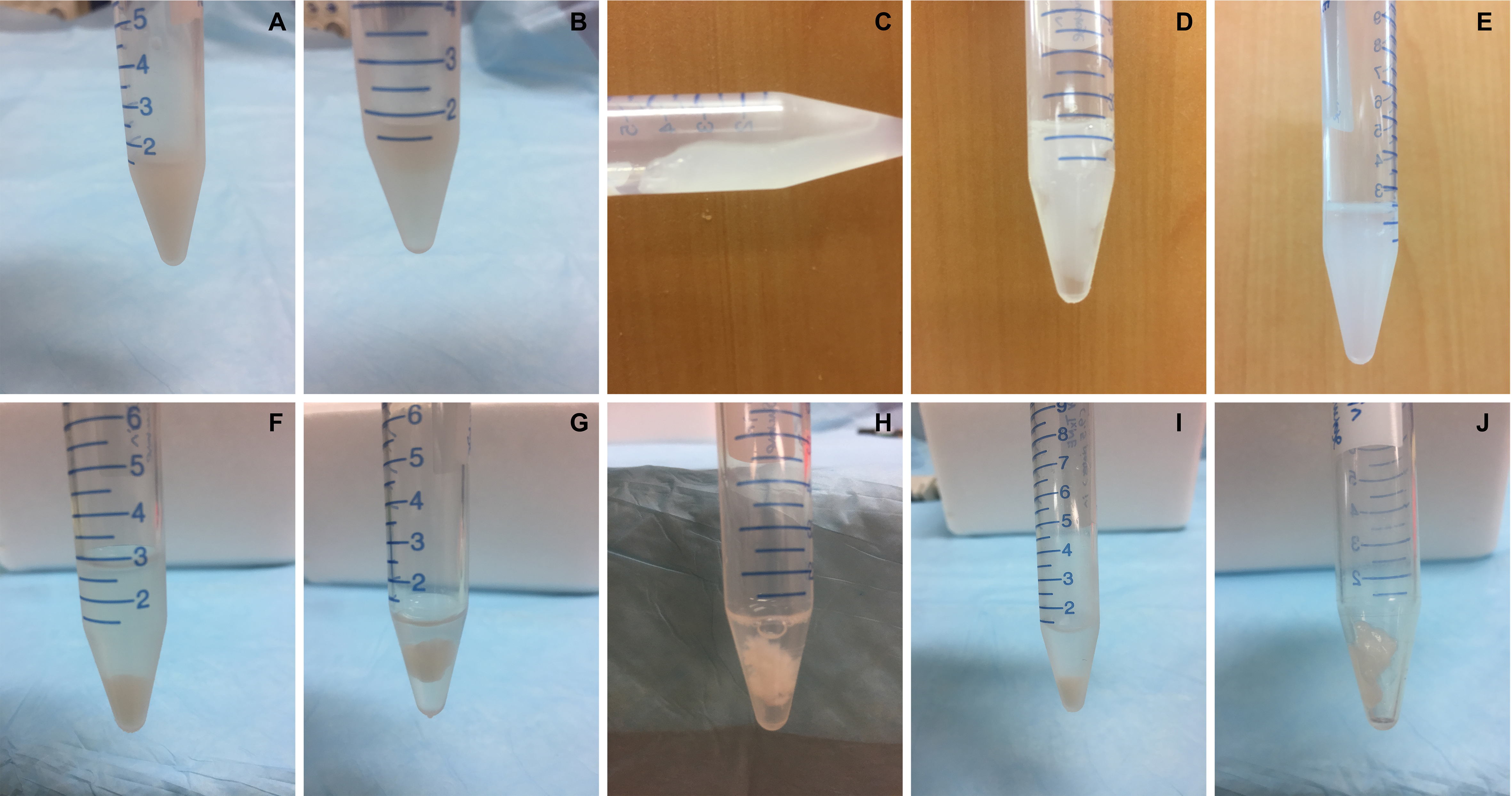 a method for extracting the nuclear scaffold from